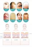 Skin Care Fractional Microneedle Vaccum Rf Machine For Skin Rejuvenation