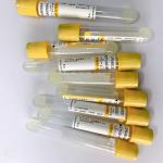 Medical Gel And Clot Activator Tube 3ml 4ml 5ml Accurate Vacuum Draw Volume