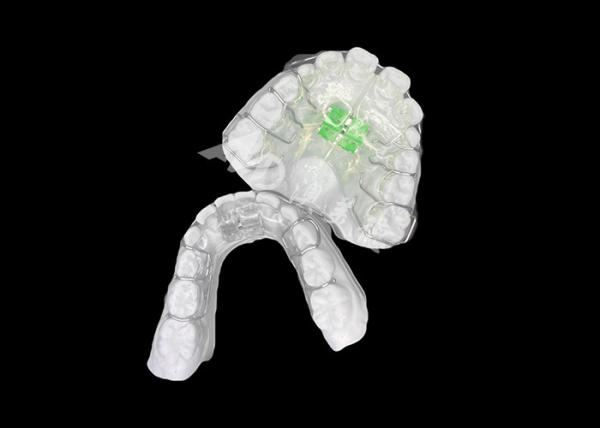 Effective Removable Orthodontic Expander For Optimal Jaw Alignment And Dental