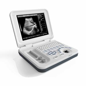 China Multipurpose Equine Vet Portable Ultrasound Machine DRF RDA factory