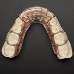 Comfortable Stainless Steel Acrylic Hawley Retainer Effective Orthodontic