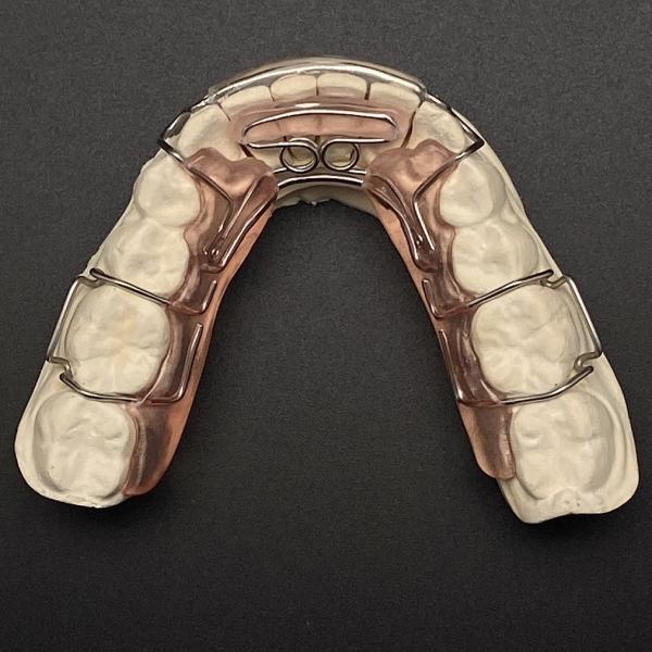 Comfortable Stainless Steel Acrylic Hawley Retainer Effective Orthodontic