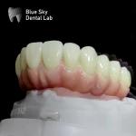 Regular Dental Implant Case Nature And Durability For Medical Equipment