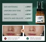 Whitening Face Lotion Alpha Arbutin Dark Spot Face Cream Lotion Skincare Facial