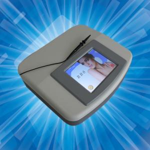 China 30MHz Spider Vein Removal Machine / Laser Vein Removal / Vascular Removal factory