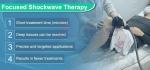 Professional Eswt Shock Wave Machine Erectile Dysfunction Ed Treatment