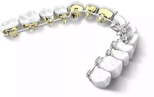 China Dental BracesFixed Orthodontic Appliances Side Back Invisible Lingual Braces Aesthetic Natural factory