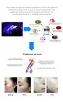 Muscle Message 635nm 660nm 850nm LED Red Light Therapy Beds For Chiropractic Use
