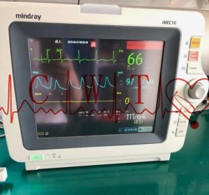 China Mindray IMEC10 SPO2 Health Patient Monitor Repair Laboratory Use factory