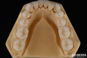 China 3D Multi Layer Dental Full Zirconia Chipping Resistance Natural Tooth Structure factory