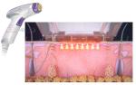 Rf Fractional Microneedle Rf Face Lifting Anti Wrinkle Machine