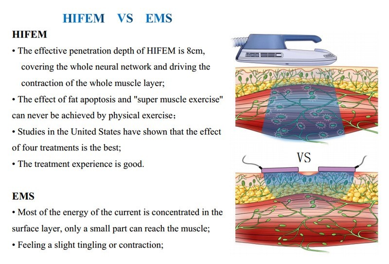 1-12hz Magnetic Weight Loss Hiemt Machine Electro Magnetic body Slim Muscle Stimulator