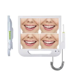 China Wifi System Dental Usb Intra Oral Camera Wireless Intra Oral Digital Camera factory