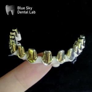 China Silver Gold Universal Pure Titanium Metal Frame Dental Customizable factory