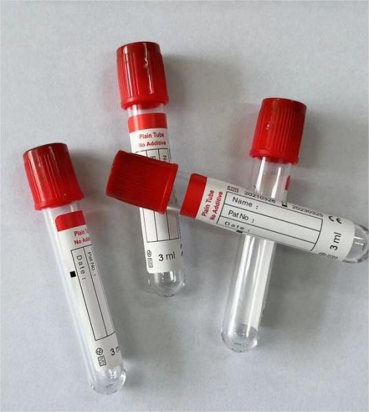 Smooth Inner Tube Wall Prevents Blood Cell Attachment in Plain Vacuum Blood