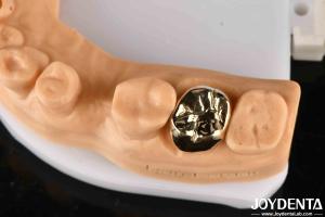 China Metallic Material Dental Gold Crown , Gold Tooth Crown For Optimal Oral Rehabilitation factory