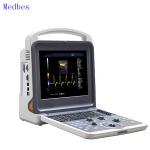 Portable Ecografo 4D Color Doppler Ultrasound Machine, Portable Echo Ultrasound