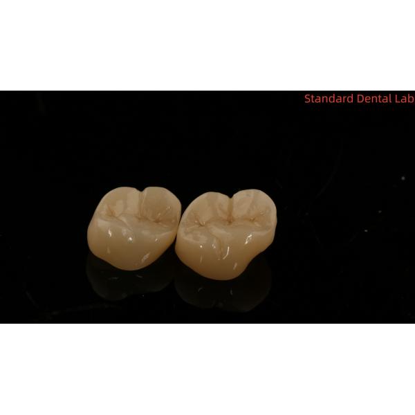 Solid Dental Lab Crowns 3D Pro High Translucency Full Zirconia Crowns with 5-Year Guarantee