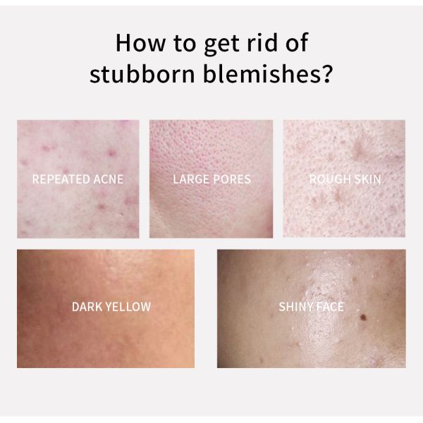 OEM Skincare Face Serum Salicylic Acid Spot Treatment Gel Serum Dermatologist 30ml