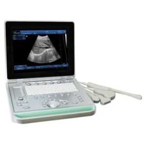 China 3D Digital B / W Portable Ultrasound Scanner With Convex Linear Transvaginal Probes factory