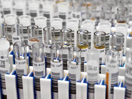 1 Head Capping Small Scale Filling Packing Line Machine for Multifunctional Test Tube