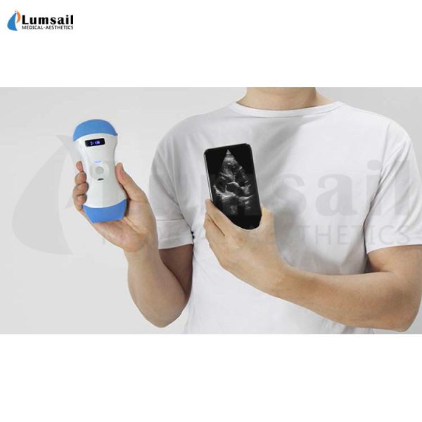China Linear Convex Phased Array 3 In 1 Handheld Pocket Ultrasound Scanner With APP factory