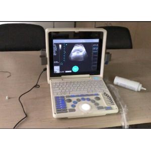 12 Inch LED Screen Portable Digital Ultrasound Scanner with All Kinds of Probes
