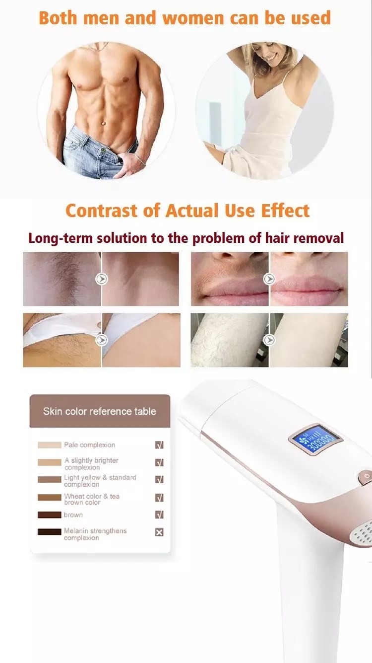 CE ROHS TM Technology 320g IPL Laser Removal Device