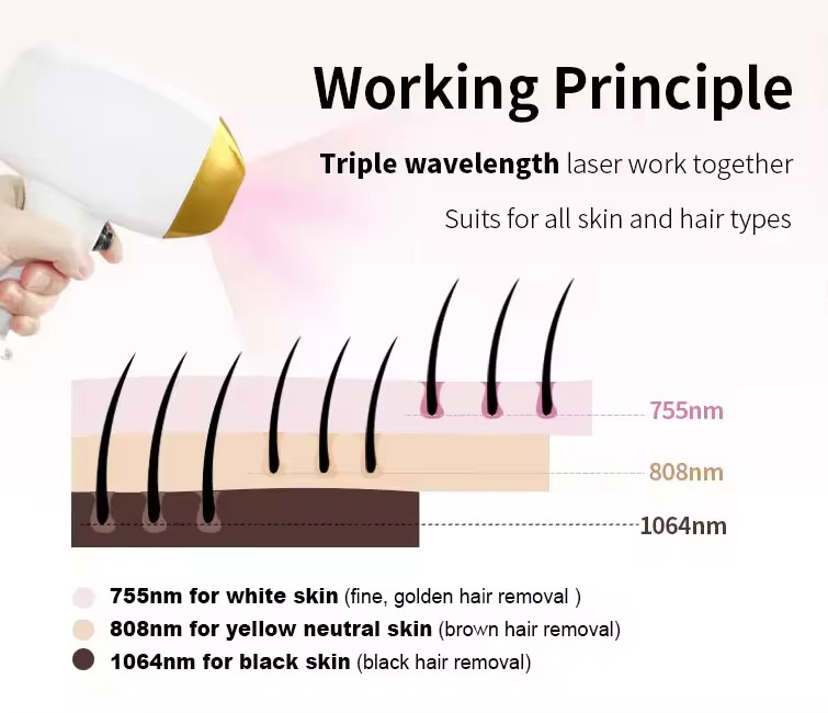 D31-3 Professional Ipl Hair Removal 808nm Diode Laser Carbon Peel Nd Yag Picosecond Laser With Measuring Rod
