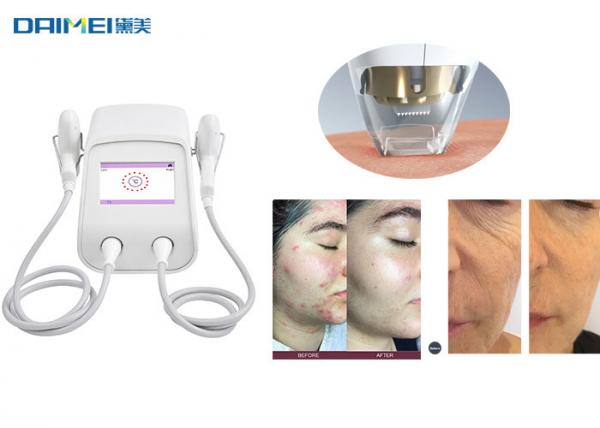 China Tixel Mezotix Skin Rejuvenation Technology Novoxel Stretch Marks Scars Removal factory