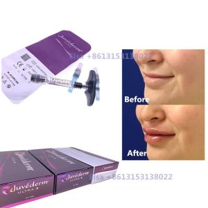 China 2×1ml Injectable Dermal Filler Juvederm Syringe Ultra3 Ultra4 Voluma factory