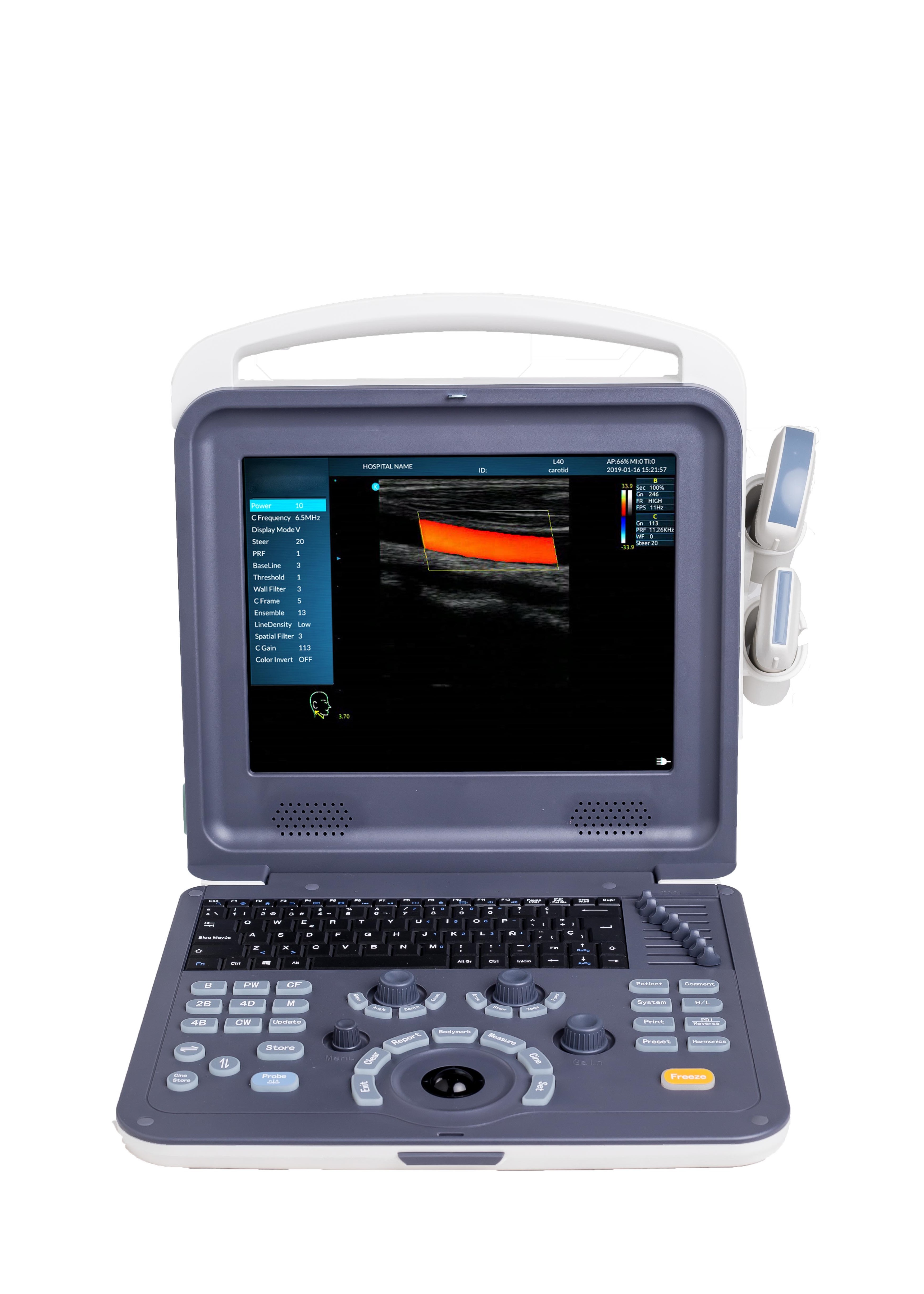 64GB Portable Ultrasound Scanner 12 Inch LED Color Monitor 4D Colour Doppler Ultrasound