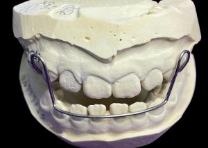 China Guide Arch Appliance Orthodontic Retainers Aligners With Good Retention Proven Convenience factory
