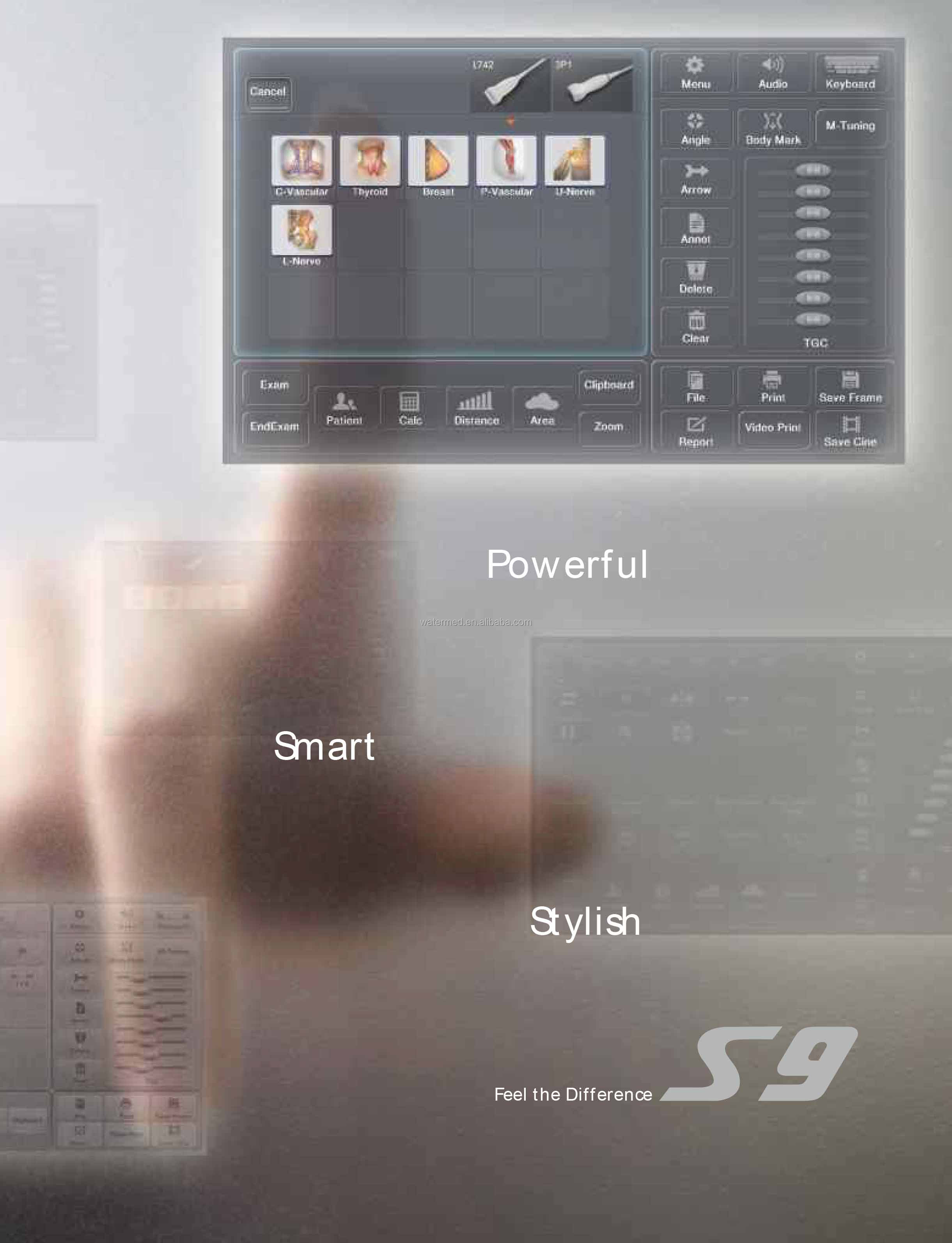 Portable 3D 4D Color Doppler USG&Sonoscape S9