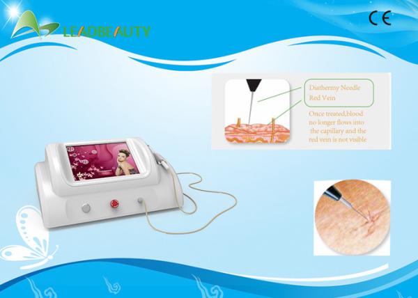 Facial Spider Vein Treatment , Laser Treatment Spider Veins With 8.4 Inch LCD
