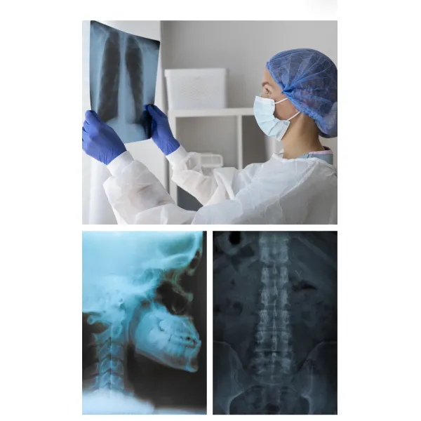 A3 A4 Medical Dry Laser Blue Base Inkjet Printable Pet X-ray Film