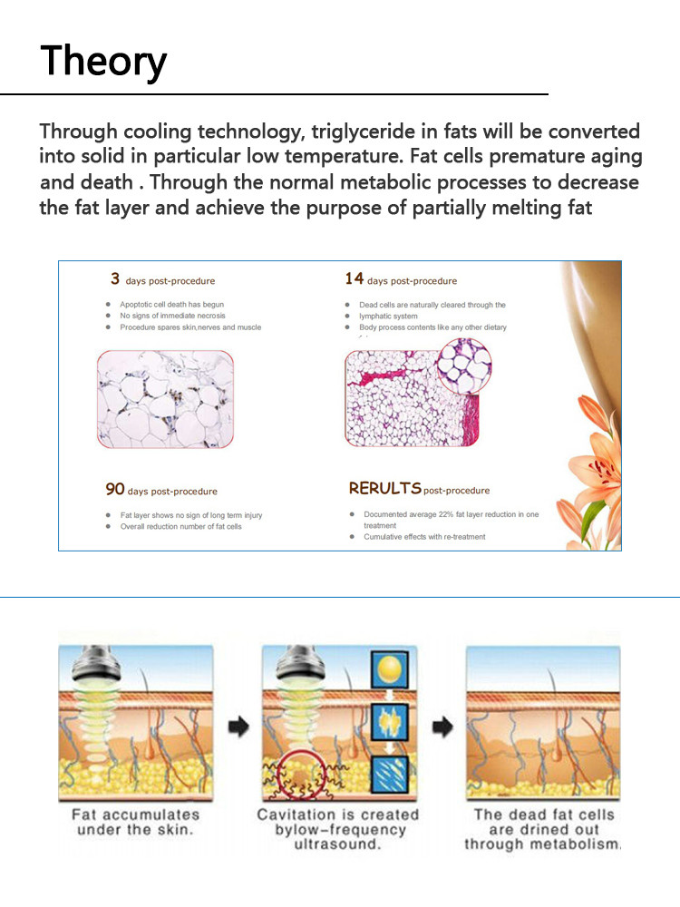 home use portable cryolipolysis device/cryolipolysis machine/cryolipolysis fat reduce machine LF-213