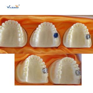China Producing Steps Of Marilan Bridge Dental Study Models For Teeth Teaching factory