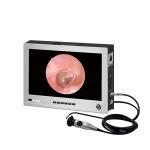 Medical Portable All In One Endoscope Camera System 26inch