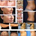 980nm 1470nm Liposuction Machine Fat Removal Laser Lipolysis Equipment