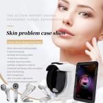 3D Digital Skin Analyzer Portable Face Skin Analysis Machine AI