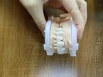 Highly Translucent Zirconia Crowns Bridge Veneers With Customized Jewelry And