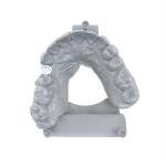 Dental Crowns Permament Resin High Precision for Superior Results in Crown