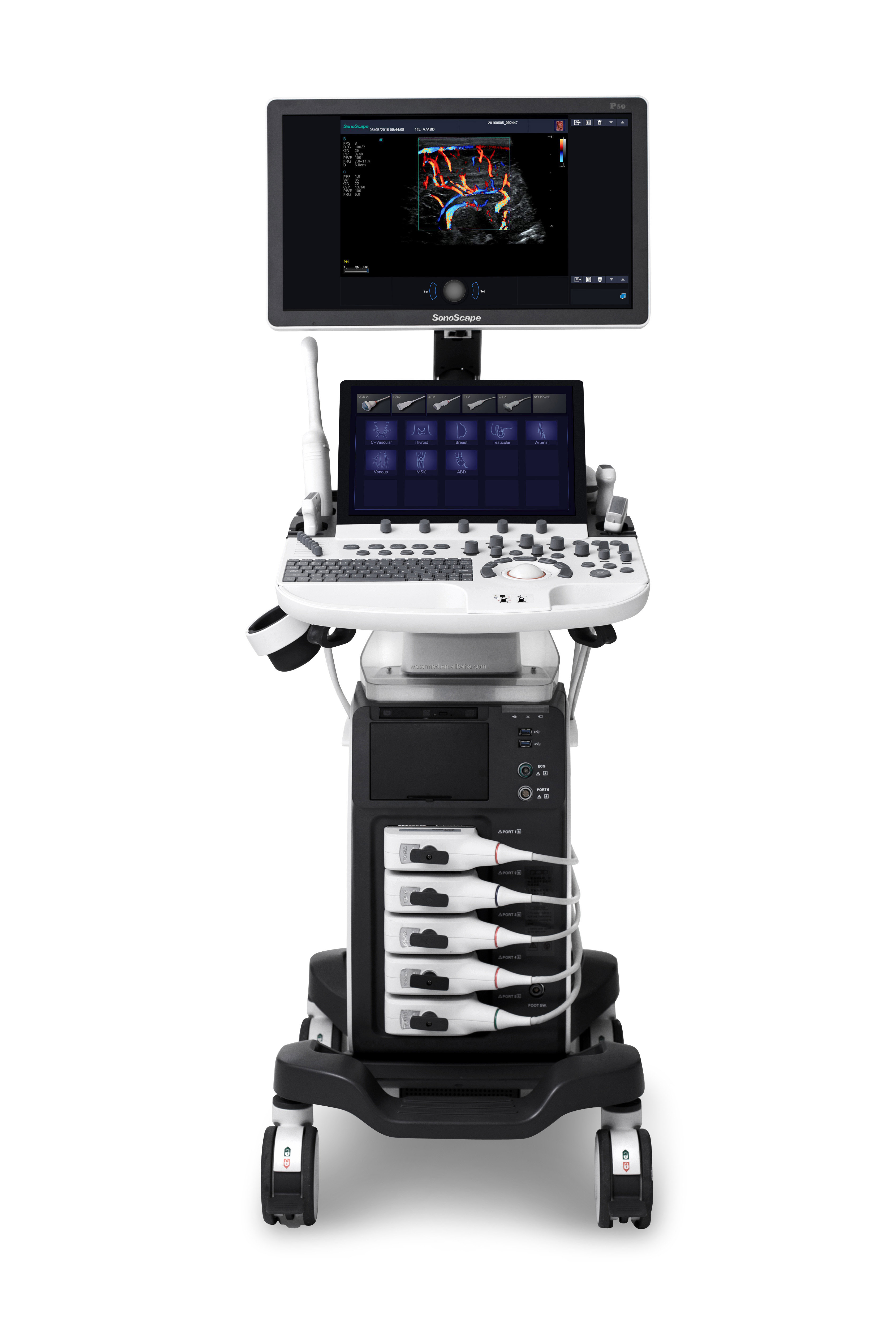 Cardiovascular Sonoscape P50 Ultrasonido Doppler Ultrasound Machine