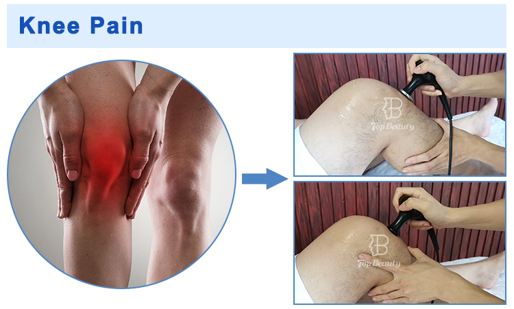 Resistive Rf Tecar Therapy Machine Sports Rehabilitation