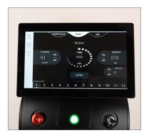 China Adjustable Energy Diode Laser Hair Removal Machine Logo Customized Logo Crystal Temperature -20-5°C factory