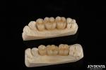 Wear Resistant Zirconia Full Contour Dental Crown High Translucency