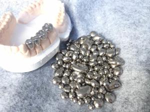 China Dental Crown High Nickel Alloys , Nickel Alloy Casting Reducing Oxide Formation factory