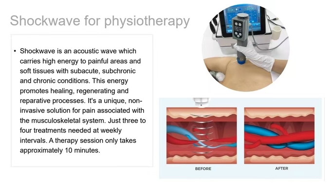 Multifunction Smart Tecar Therapy Machine Shockwave ED Treatment
