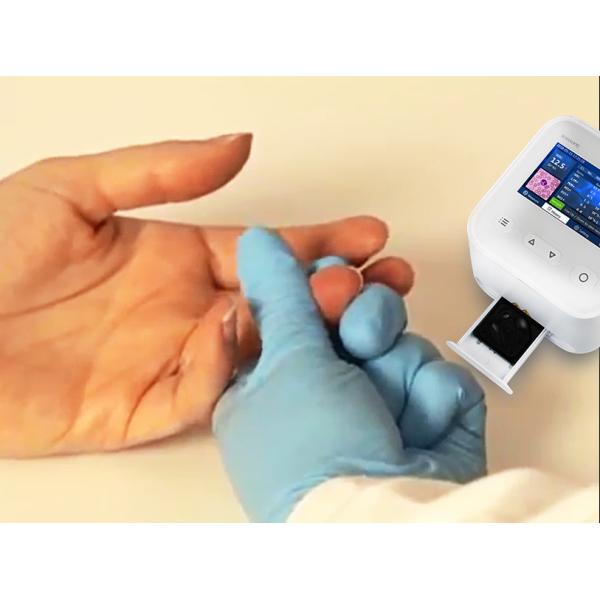 POCT device (WBC-6) Colorful screen hematology WBC Analyzer with microfluidics chips